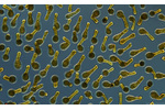 Obr. 5: Mikroskopický snímek lahvenky velké.  Mikroskopický snímek lahvenky velké. Jak název napovídá, buňky mají lahvovitý tvar o délce 200–300 mikrometrů.