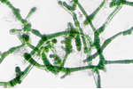 Cyanobacterium Aetokthonos hydrillicola Cyanobacterium Aetokthonos hydrillicola